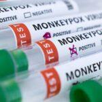 Opičí neštovice a jejich politické pozadí